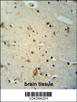 CIC Antibody抗体，orb1270648，bior