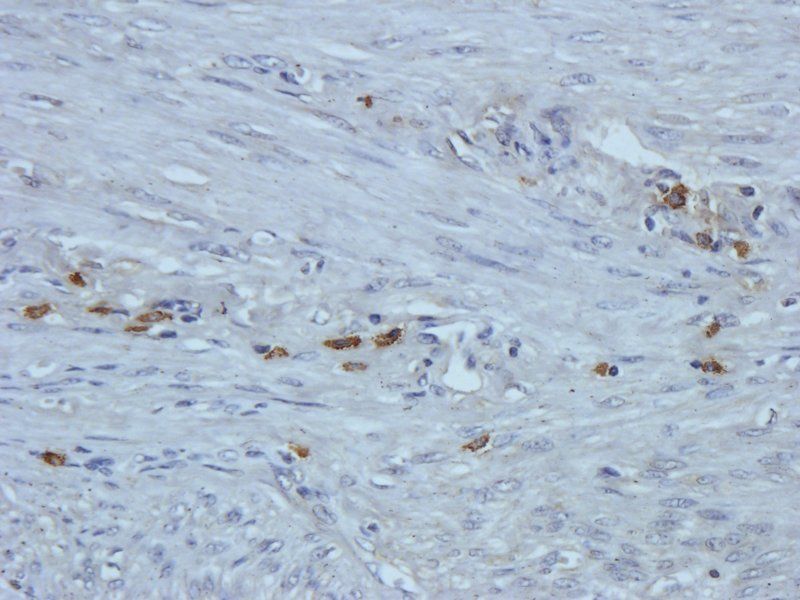 IL4 antibody抗体，orb318727，biorb