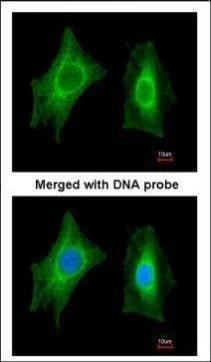 PSPH antibody抗体，orb556588，bior