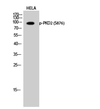 PKD2 (phospho Ser876) rabbit p