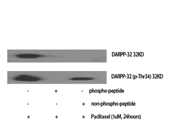 DARPP-32 (phospho Thr34) rabbi