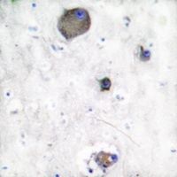 LYN (Phospho-Y508) Antibody抗体,