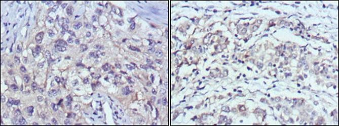 PAK2 Antibody抗体，orb97576，biorb