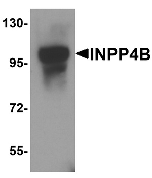 INPP4B Antibody抗体，orb1239643，b