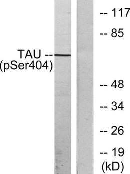 Tau (phospho Ser404) rabbit pA