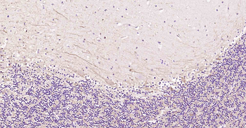 Tau-4 Mouse Monoclonal Antibod