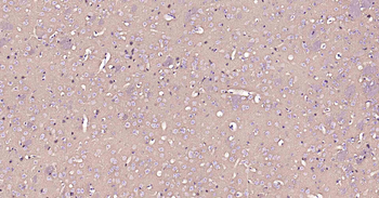 ATP1B1 Recombinant Rabbit Mono