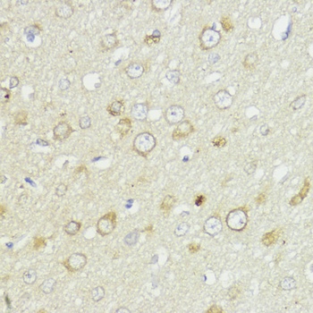 BCL2 Antibody抗体，orb1261316，bio