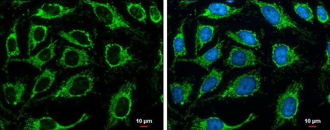 Citrate synthase antibody [N2C
