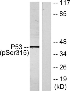 p53 (phospho Ser315) rabbit pA