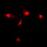 Galectin 3 Antibody [KO/KD Val