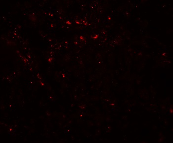 LIMA1 Antibody抗体，orb1239521，bi