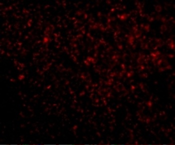 TREX1 Antibody抗体，orb1238690，bi