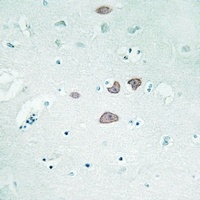 STON1 Antibody抗体，orb665761，bio