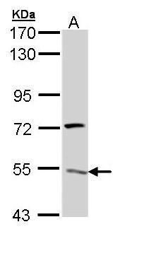 ATP6V1H antibody [N3C3]抗体，orb5