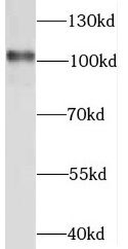 STAT6 Antibody抗体，orb631574，bio