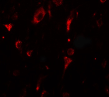 SGSM2 Antibody抗体，orb1238991，bi