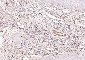 S100A4 Mouse Monoclonal Antibo