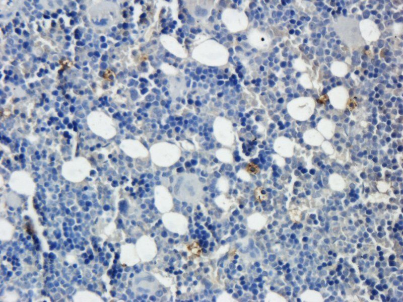 Desmocollin 1 antibody抗体，orb10