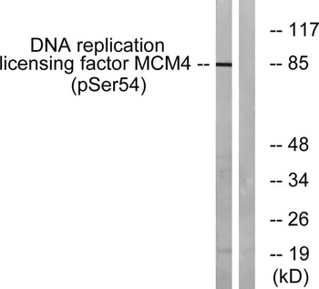 MCM4 (phospho Ser54) rabbit pA