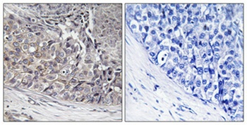 ADCK4 rabbit pAb抗体，orb764477，b