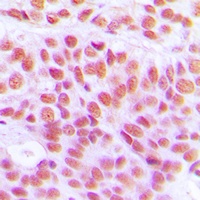 Histone H4 (Acetyl-K12) Antibo