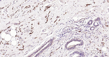 STMN1 Mouse Monoclonal Antibod