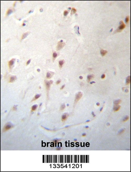 FOXJ3 Antibody抗体，orb1269026，bi