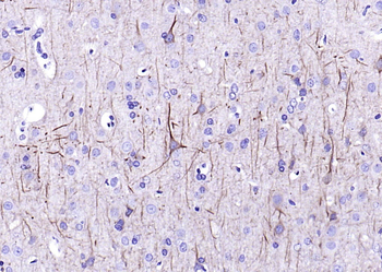 NF-L Mouse Monoclonal Antibody