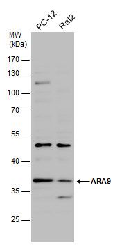 ARA9 antibody [N1C3]抗体，orb5567