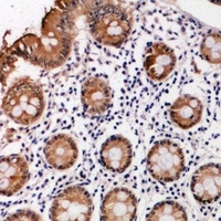 PI3K p101 Antibody抗体，orb515344