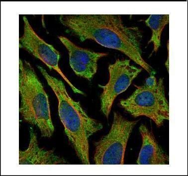 Villin antibody抗体，orb556653，bi