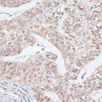 RBM17 Antibody抗体，orb1257908，bi