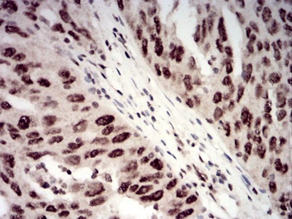 CBX1 Antibody抗体，orb229746，bior