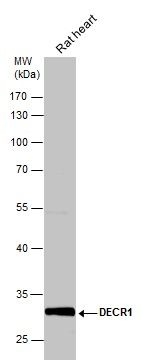 DECR1 antibody [N1C3]抗体，orb556