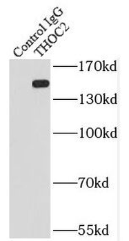THOC2 Antibody抗体，orb631875，bio