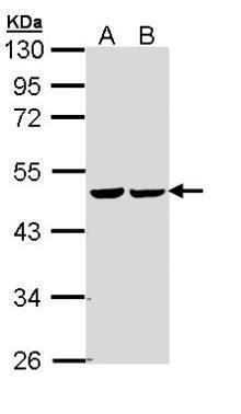 Fumarate hydratase antibody [N