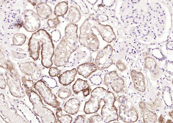 CD138 Recombinant Rabbit Monoc