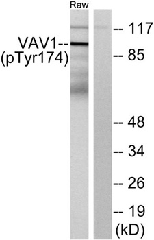 Vav1 (phospho Tyr174) rabbit p