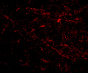 SIRT2 Antibody抗体，orb1238965，bi