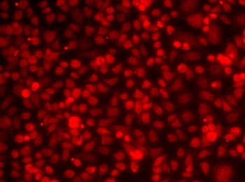 ILF2 Antibody抗体，orb1257274，bio