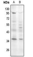 Cyclin D1 (Phospho-S90) Antibo