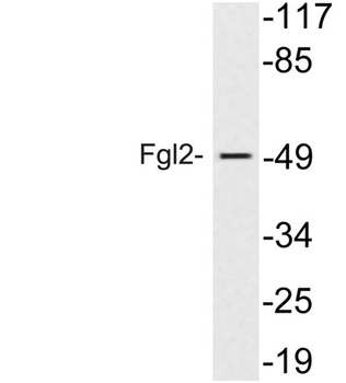Fgl2 rabbit pAb抗体，orb765216，bi