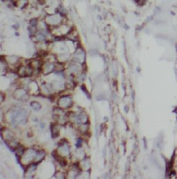 EGFR Antibody抗体，orb756522，bior