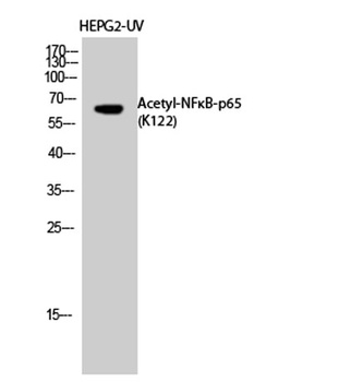 NFκB-p65 (Acetyl Lys122) rabbi