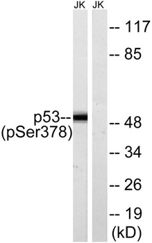 p53 (phospho Ser378) rabbit pA