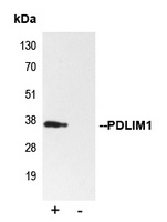 PDLIM1 Antibody [KO/KD Validat