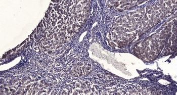 Paxillin (phospho Tyr88) rabbi