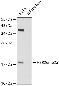 Asymmetric DiMethyl-Histone H3