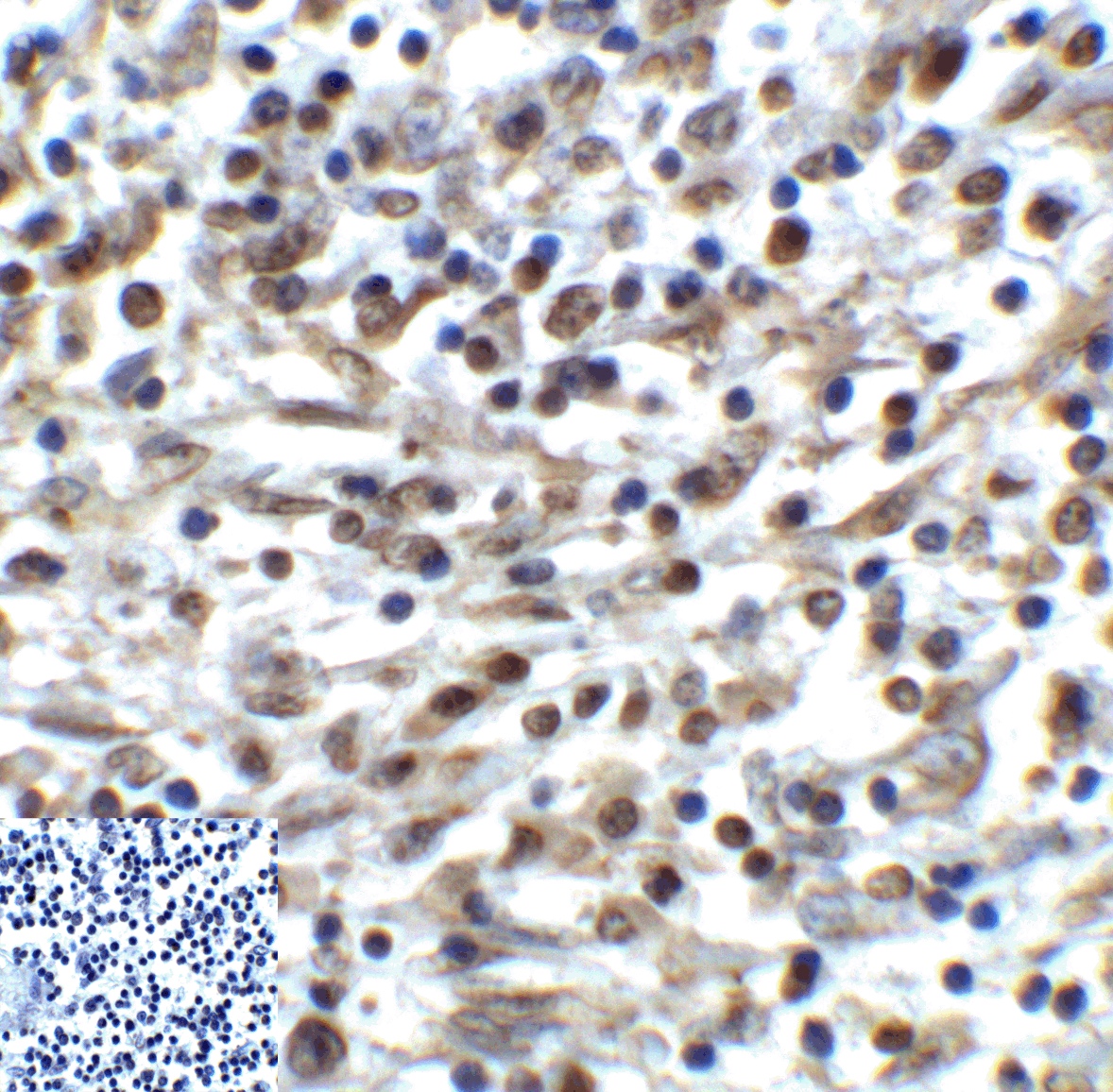 TIGIT Antibody [4A10]抗体，orb124